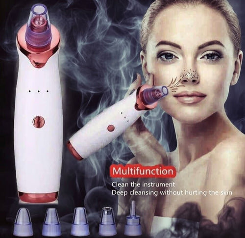 Electric Blackhead Remover & Pore Vacuum Cleaner – Rechargeable